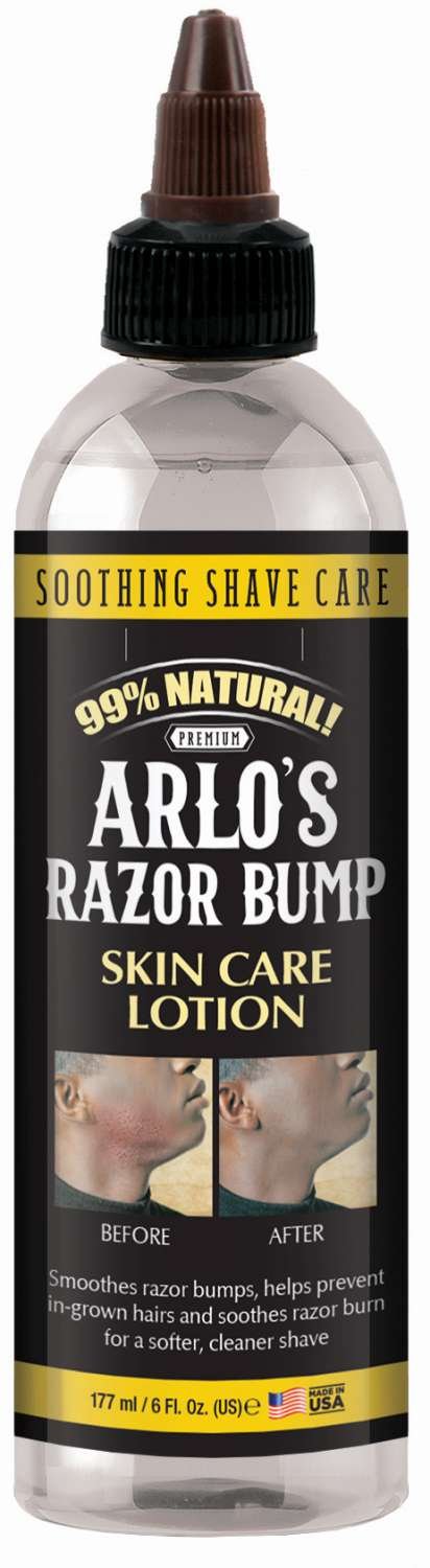Arlo’s Razor Bump Skin Care Lotion
